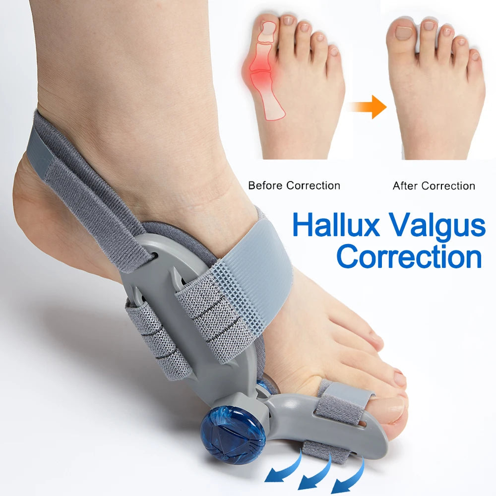 Bunion Splint Big Toe Straightener Hallux Valgus Correction Orthotics Foot Bone Thumb Adjuster Correction Bunions Corrector